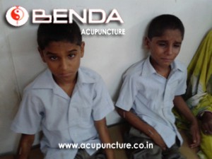 Benda Acupuncture