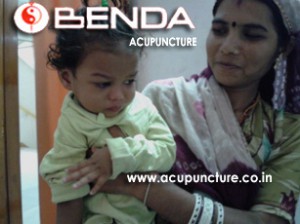 Benda Acupuncture