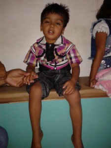 Cerebral Palsy, Mental Retardation (Down’s Syndrome Mangolism) ,cerebral palsy benda acupuncture, acupunture,acupunture in rajasthan,acupunture in india,acupunture in jodhpur,jodhpur,acupuncturist india,acupuncture specialist, www.acupunture.co.in, dr. benda, dr hemant benda, acupuncturist, cerebral palsy, cerebral palsy treatment, cerebral palsy treatment in india, slip disc, knee pain(o.a.), migraine, weight loss, cervical pain, sciatica, paralysis, height increase, benda acupuncture, acupunture, acupunture in rajasthan, acupuncture treatment in india,acupuncture in india, acupuncture in jodhpur, jodhpur, acupuncturist india, acupuncture specialist, www.acupunture.co.in, dr. benda, dr hemant benda, acupuncturist, cerebral palsy, cerebral palsy treatment, cerebral palsy treatment in india, cerebral palsy treatment in jodhpur, cerebral palsy treatment by acupuncture, cerebral palsy, pulsy, palsy, slip disc, knee pain(o.a.), migraine, weight loss, cervical pain, sciatica, paralysis, height increaselsy treatment