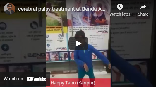 Cerebral-palsy-recovered-patient-at-benda-acupuncture-centre